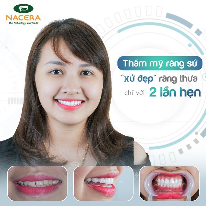 Hình ảnh đội ngũ bác sĩ chuyên môn cao tại Nha khoa Nacera