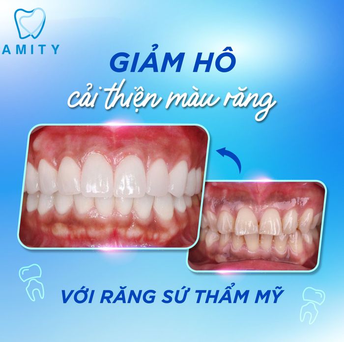 Hình ảnh phòng khám tiêu chuẩn 5 sao tại Nha Khoa Amity