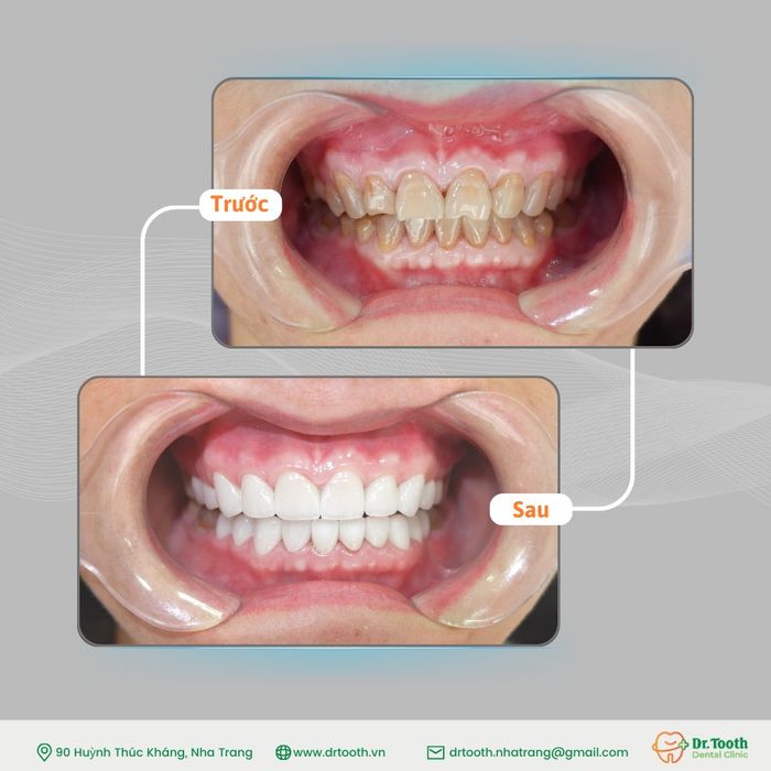 Hình ảnh cơ sở vật chất hiện đại tại Nha Khoa Dr.Tooth