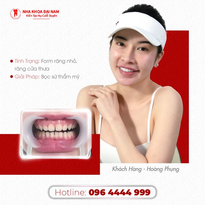 Hình ảnh phòng khám đạt chuẩn quốc tế tại Nha Khoa Sài Gòn