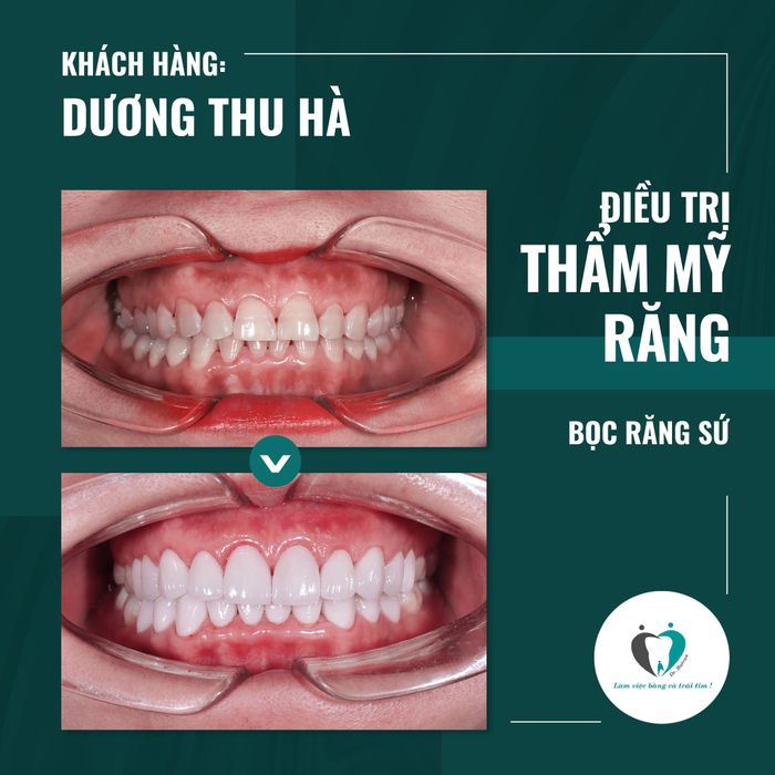 Không gian hiện đại đạt chuẩn Hàn Quốc tại Nha khoa Hà Nội Seoul