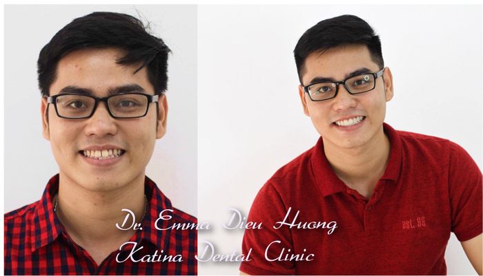 Hình ảnh thực tế Nha Khoa Katina