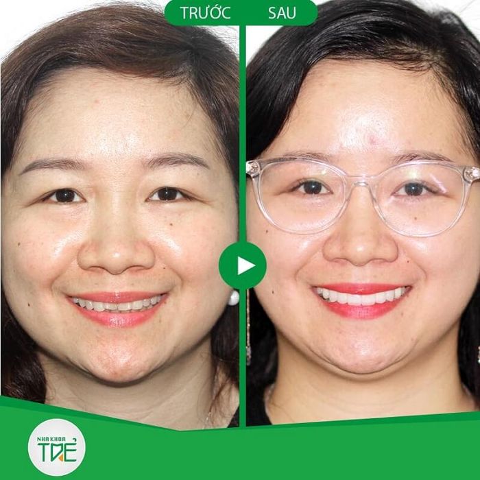 Nha Khoa Trẻ - Hình ảnh 2: Đội ngũ bác sĩ tay nghề cao cùng trang thiết bị tân tiến