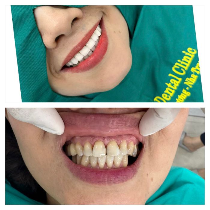Hình ảnh phòng khám tiêu chuẩn 5 sao tại Nha Khoa Tân Mỹ