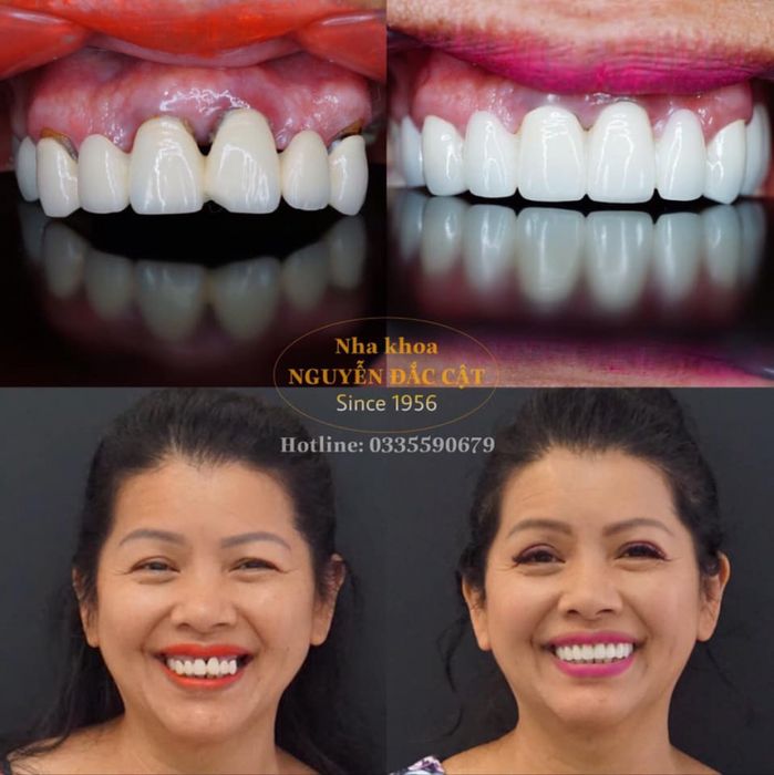 Hình ảnh phòng khám tiêu chuẩn quốc tế tại Nha Khoa Nguyễn Đắc Cật