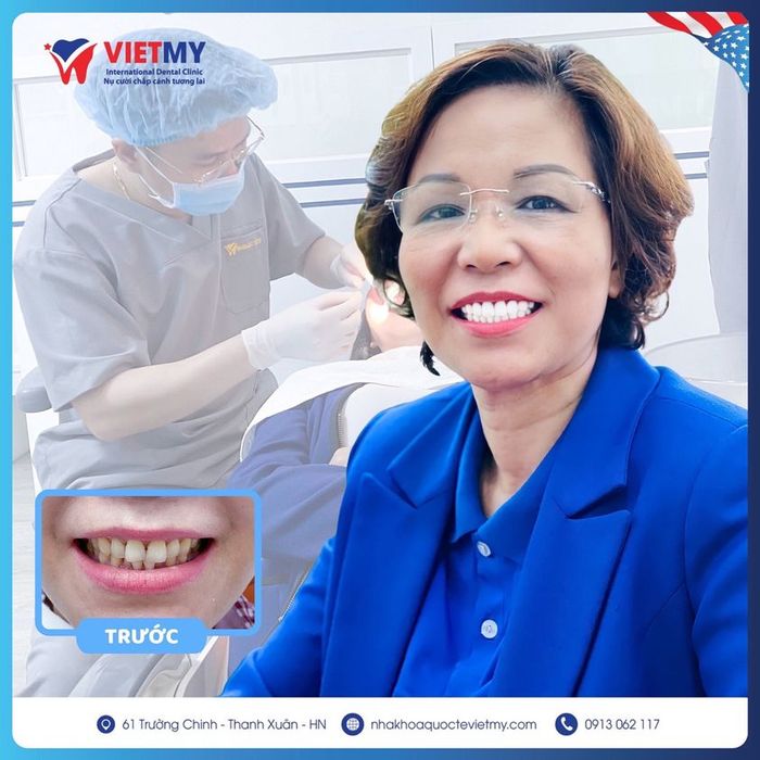 Nha Khoa Quốc Tế Việt Mỹ - Hình ảnh 2: Quy trình bọc răng sứ Lava chuẩn Mỹ