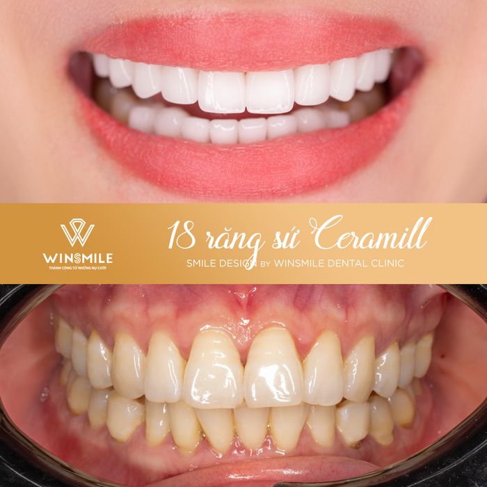 Hình ảnh phòng khám tiêu chuẩn quốc tế tại Win Smile