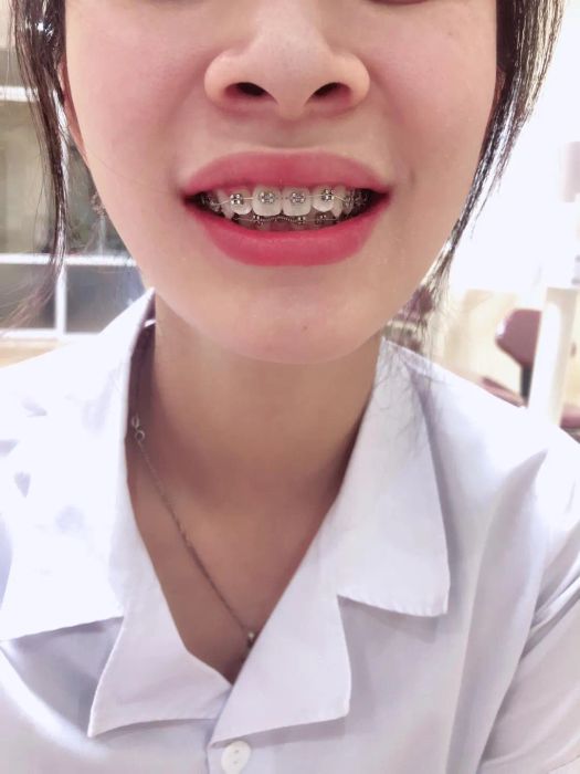 Hình ảnh phòng khám đạt chuẩn quốc tế tại Nha Khoa Nacera