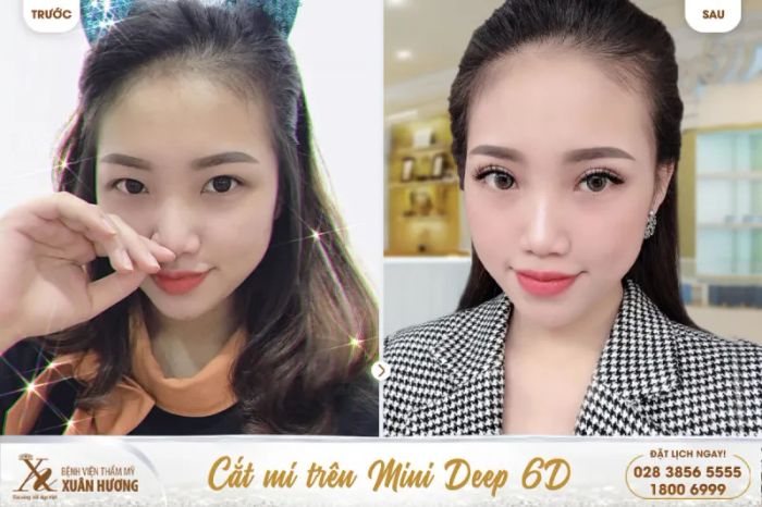 Không gian sang trọng đạt chuẩn 5 sao tại Bệnh Viện Thẩm Mỹ Xuân Hương