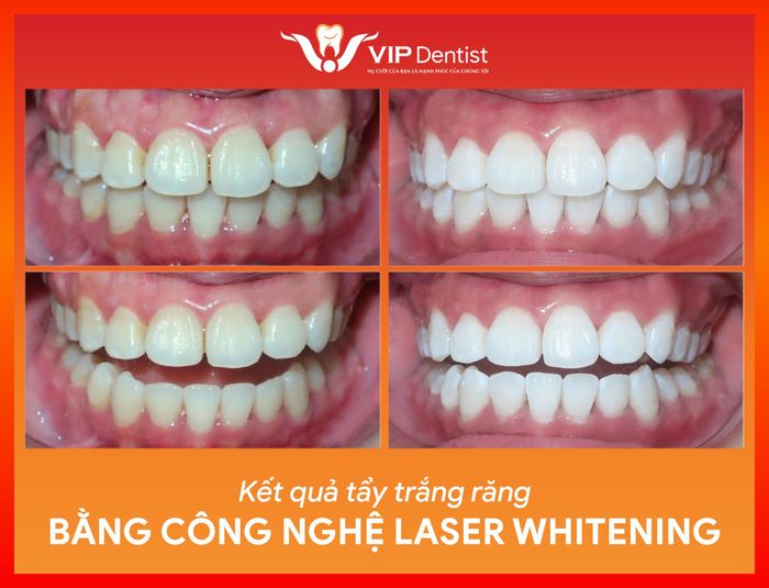 Không gian hiện đại tại Nha khoa Quốc tế Vip Dentist