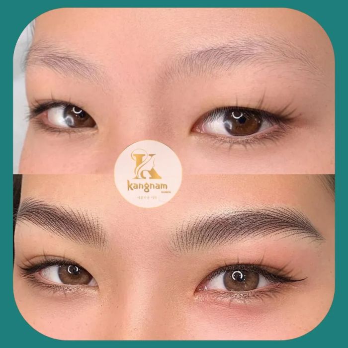 Hình ảnh thực tế tại Viện Thẩm Mỹ Kangnam Korea (1)