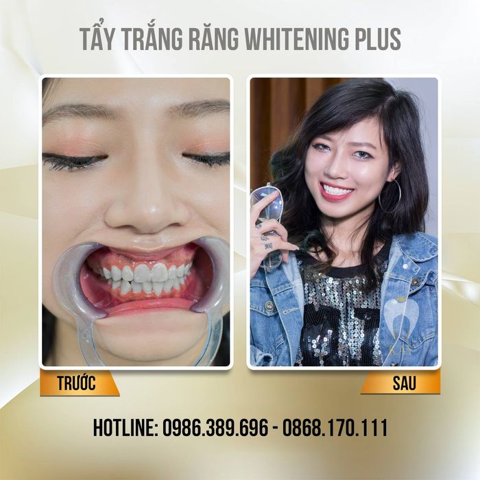 Hình ảnh Nha Khoa Quốc Tế Kay