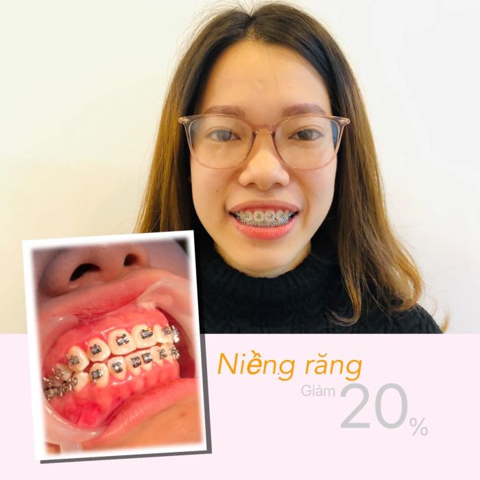 Nha Khoa Quốc Tế Kay – Hình ảnh 1