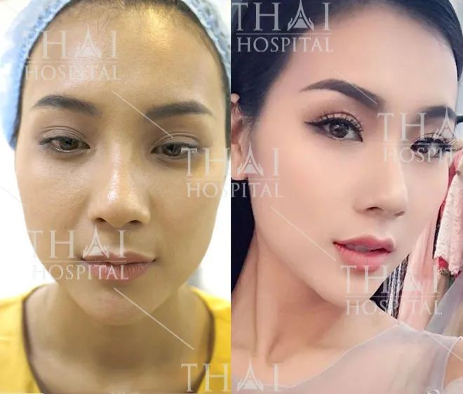 Không gian sang trọng đạt chuẩn quốc tế tại Thẩm Mỹ Viện Thai Hospital