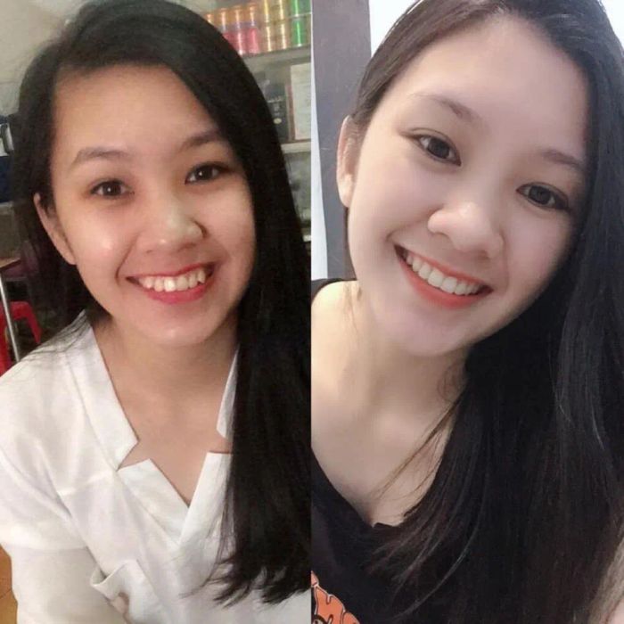 Hình ảnh Nha Khoa DIVA Hải Dương