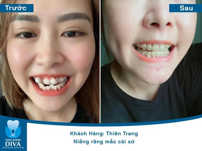 Hình ảnh không gian hiện đại tại Nha Khoa DIVA Hải Dương
