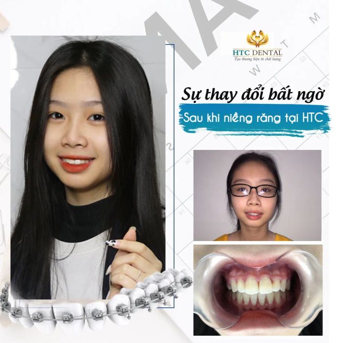 Hình ảnh cơ sở vật chất hiện đại tại Nha Khoa HTC Hải Dương