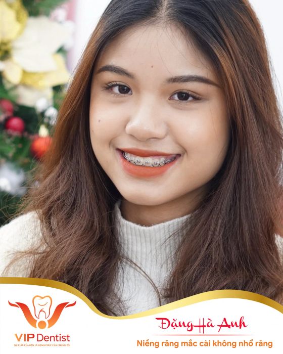 Nha Khoa Quốc Tế Vip Dentist – Hình ảnh 2