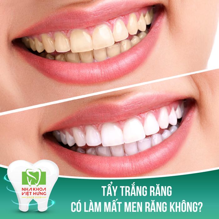 Nha Khoa Thẩm Mỹ Việt Hưng ảnh 2