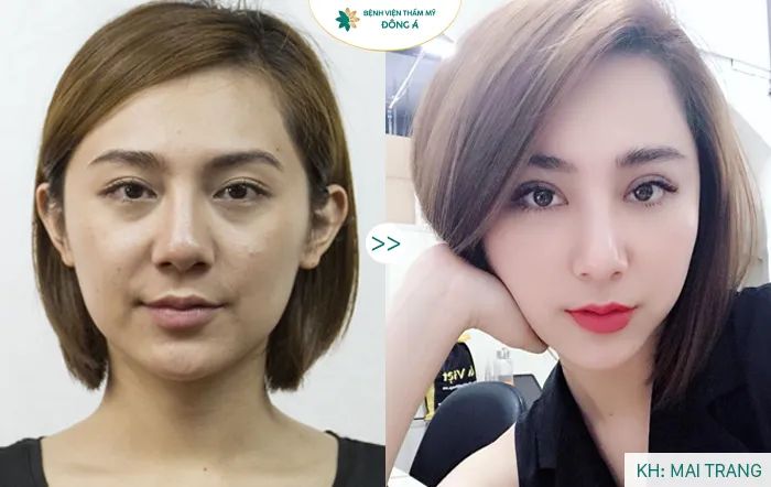 Không gian sang trọng đạt chuẩn quốc tế tại Thẩm Mỹ Viện Đông Á
