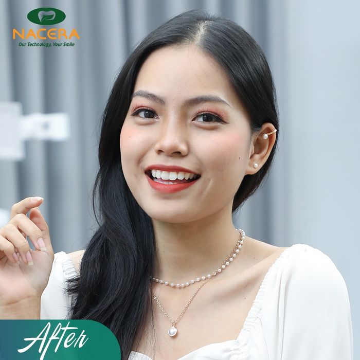 Hệ thống máy móc hiện đại tại Nha khoa Nacera