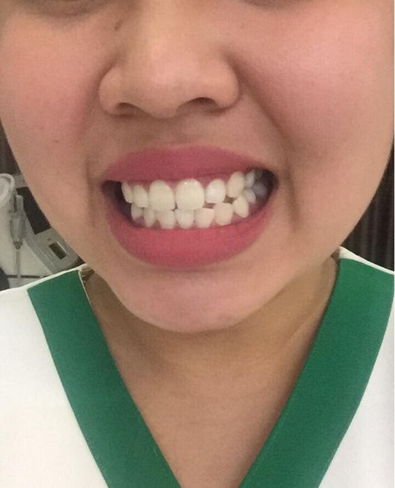 Nha Khoa Quốc Tế Shine Smile ảnh 1