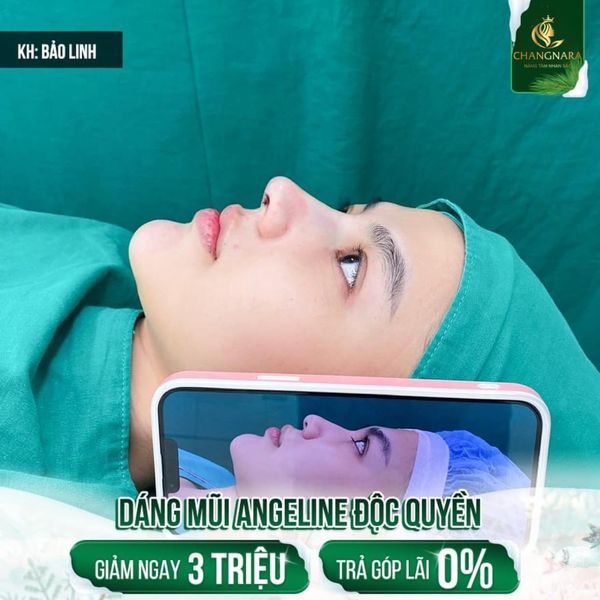 Phòng thực hiện dịch vụ đạt chuẩn quốc tế tại Viện Thẩm Mỹ Changnara