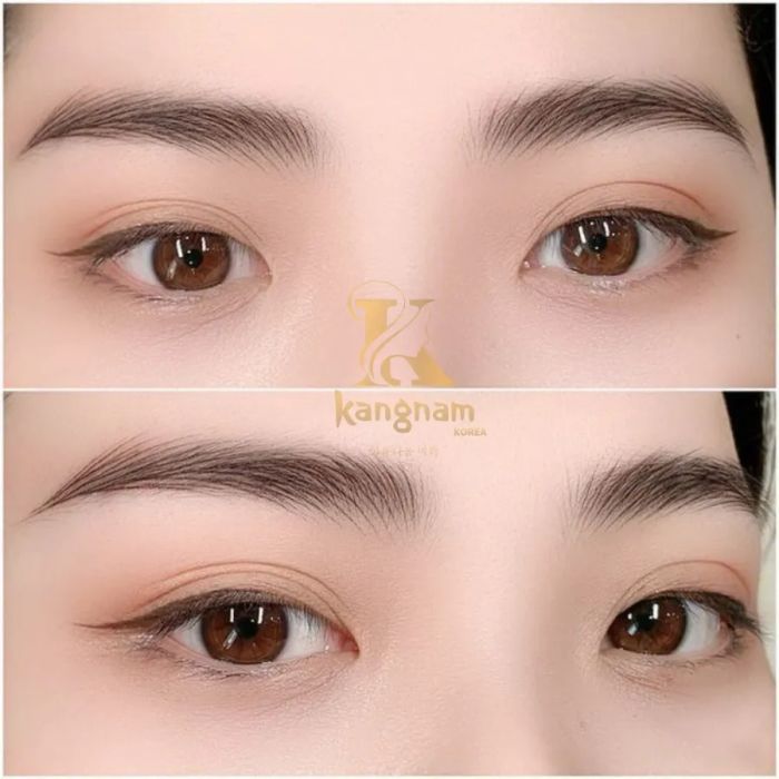 Hình ảnh thực tế tại Viện Thẩm Mỹ Kangnam Korea (2)