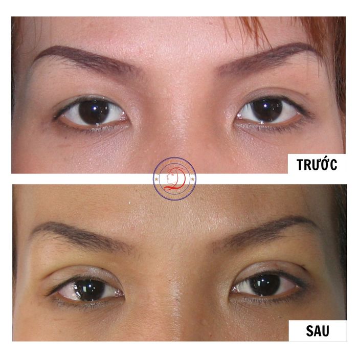 Thẩm mỹ Bs Dũng Nha Trang ảnh 2