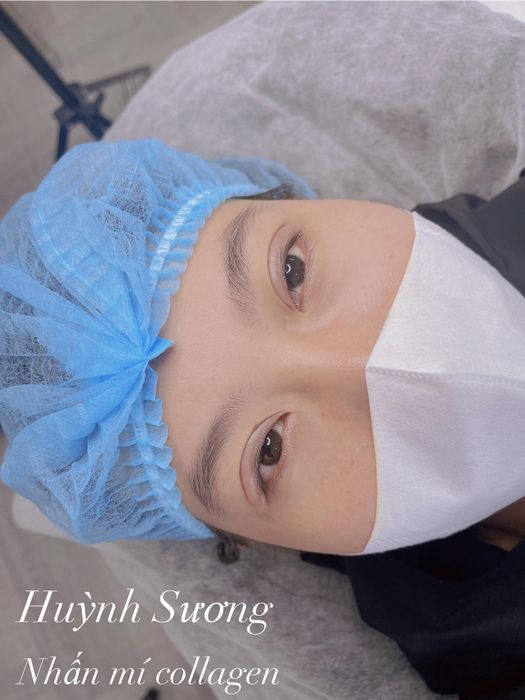 Viện Thẩm Mỹ Anna Huỳnh ảnh 2