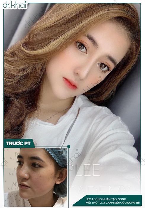 Không gian hiện đại và hệ thống trang thiết bị tiên tiến tại Trung Tâm Thẩm Mỹ Dr. Khải
