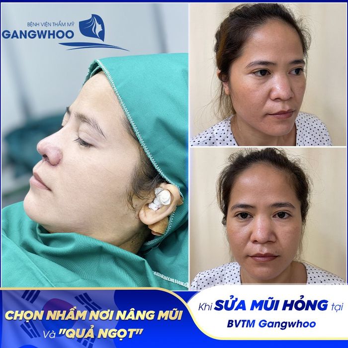 Hình ảnh cơ sở vật chất hiện đại tại Bệnh viện thẩm mỹ Gangwhoo