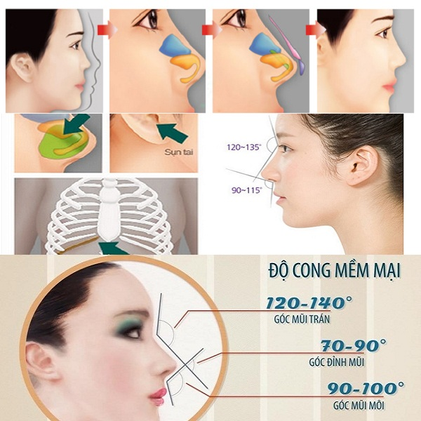 Nâng mũi cấu trúc ảnh 1