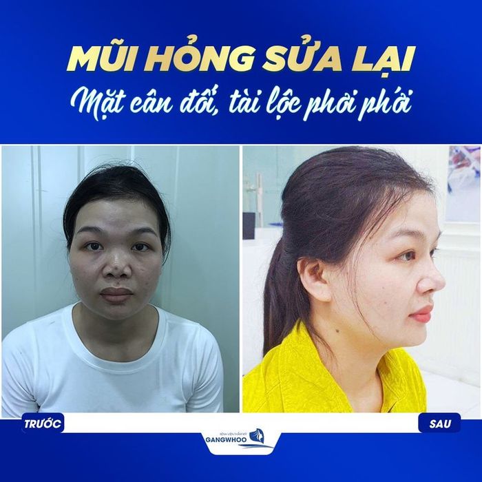 Không gian phẫu thuật vô trùng tại Bệnh viện thẩm mỹ Gangwhoo