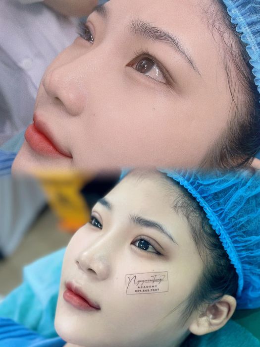 Viện Thẩm Mỹ Y Khoa Bs. Nguyễn Văn Tường ảnh 2