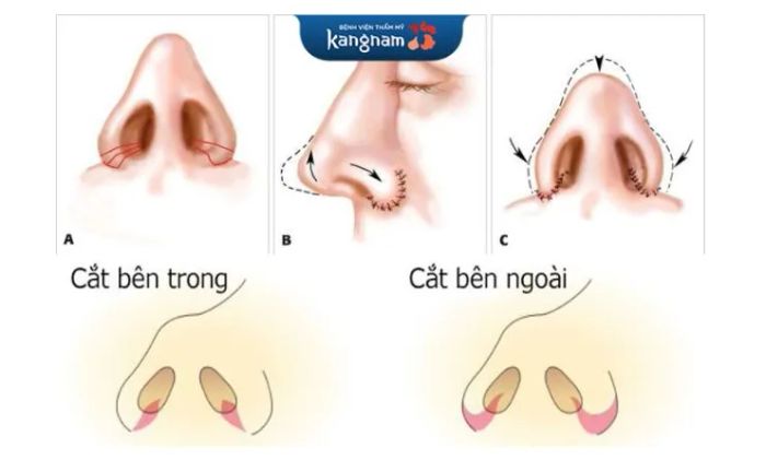 Cơ sở vật chất hiện đại tại Bệnh viện Thẩm mỹ Kangnam - Ảnh 1