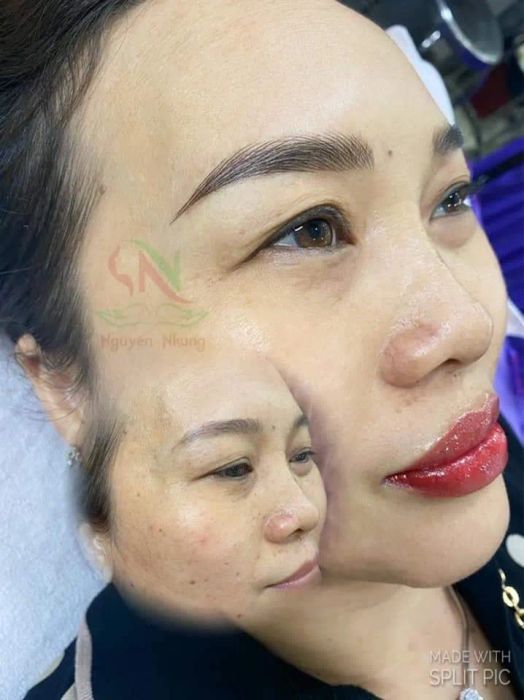 Hệ thống máy móc công nghệ cao tại Thẩm Mỹ Viện Nguyên Nhung