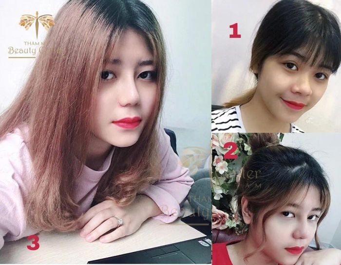 Quy trình thẩm mỹ chuyên nghiệp tại Thẩm mỹ viện Tấm - Ảnh 2