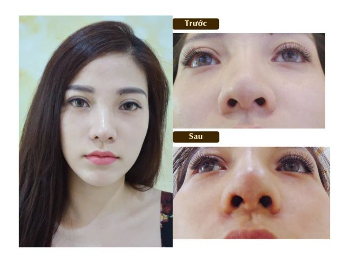 Quy trình thẩm mỹ chuyên nghiệp tại Xuân Hương - Ảnh 2