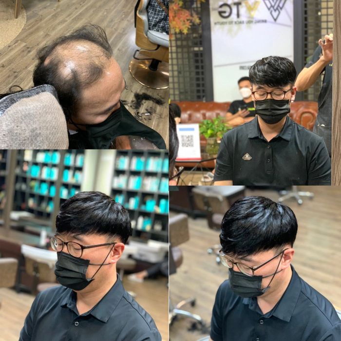 Hình ảnh Vua Tóc Giả 2