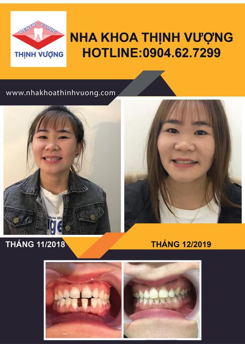Nha Khoa Thịnh Vượng hình ảnh 2