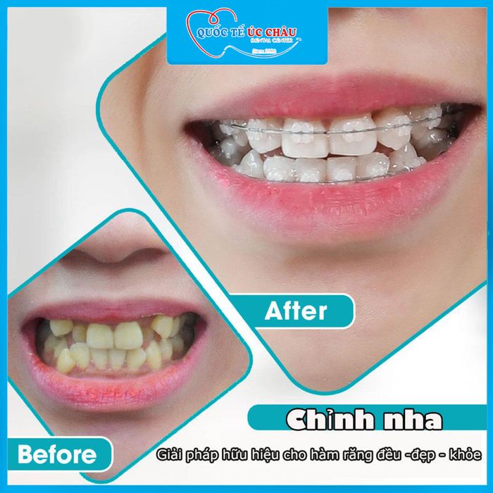 Nha Khoa Quốc Tế Úc Châu hình ảnh 2
