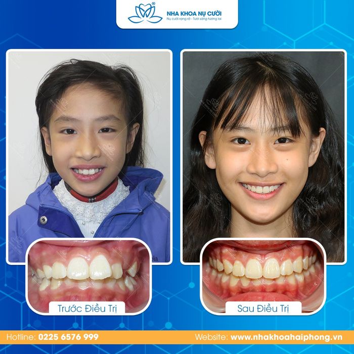 Nha Khoa Nụ Cười hình ảnh 3