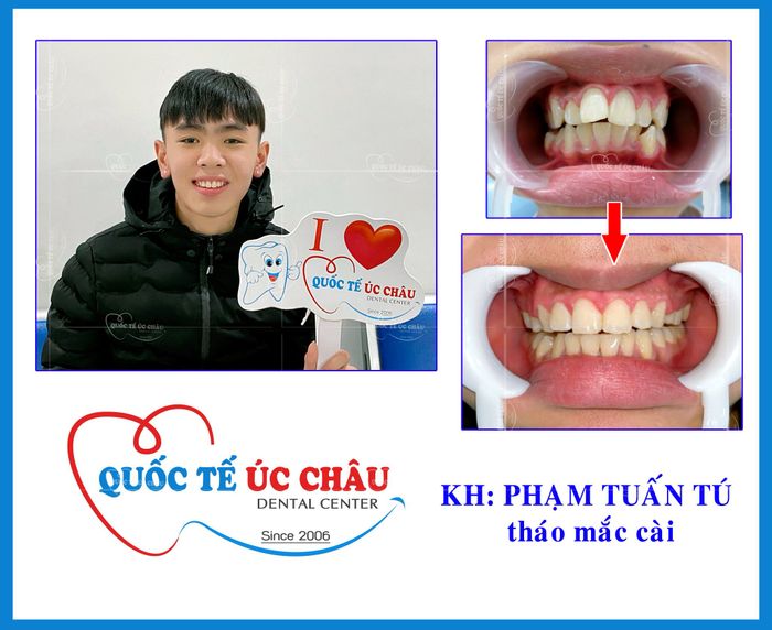 Nha Khoa Quốc Tế Úc Châu hình ảnh 3