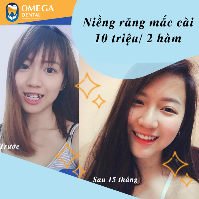 Nha Khoa Omega ảnh 3