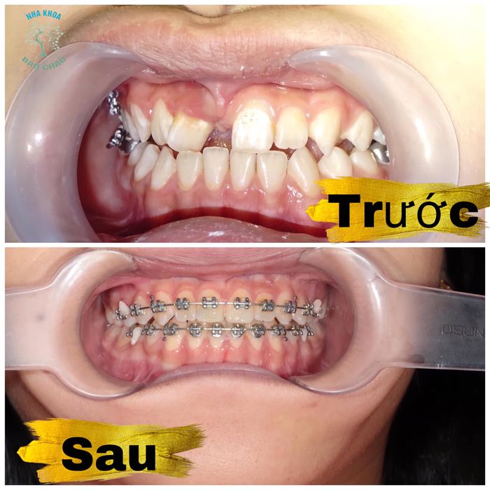 Nha Khoa Bảo Châu hình ảnh 2