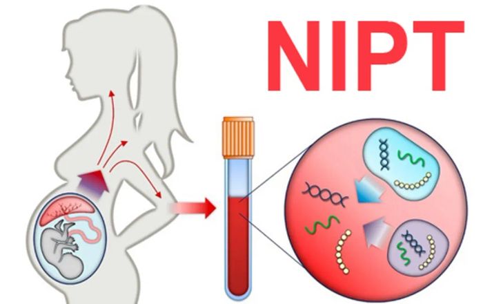 Xét nghiệm NIPT ihope - Ảnh 2