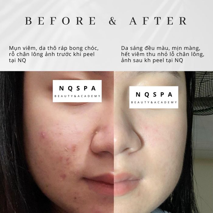 NQ Spa ảnh 1