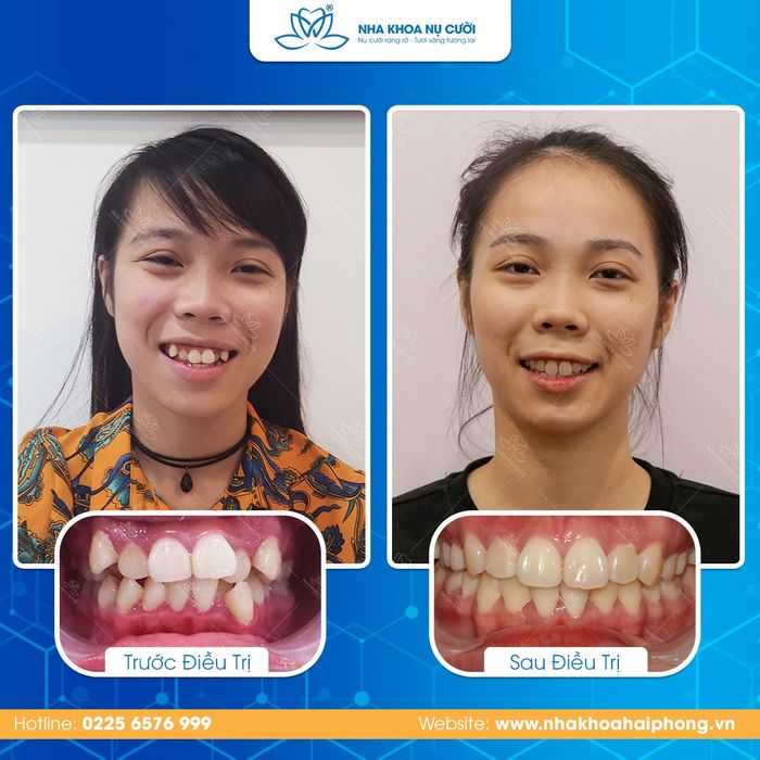 Nha Khoa Nụ Cười hình ảnh 2