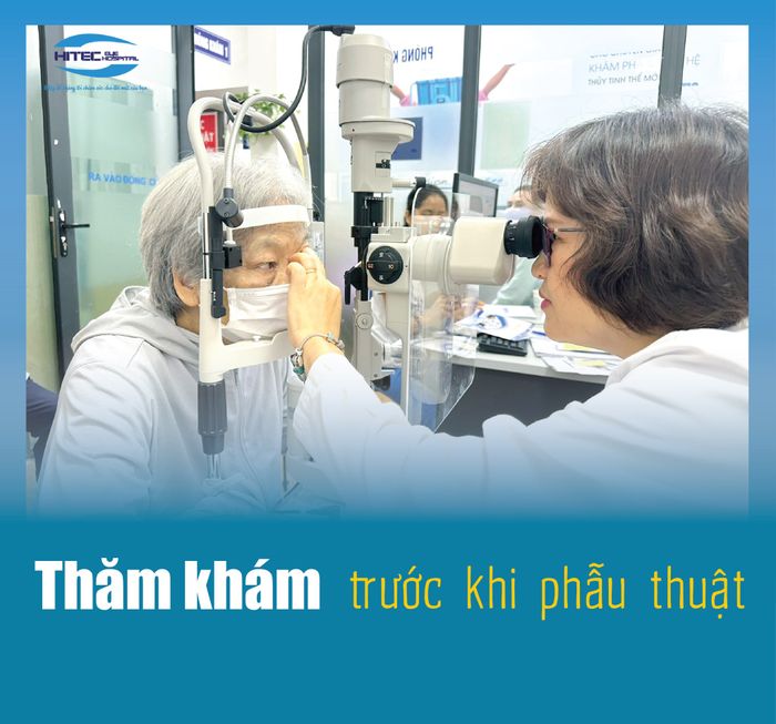 Hình ảnh đội ngũ bác sĩ chuyên môn cao đang thực hiện phẫu thuật tại Bệnh viện Mắt Hitec